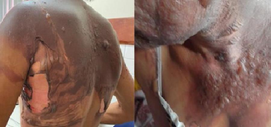 Homem que queimou companheira com água quente em Ipiaú é preso em Maracás